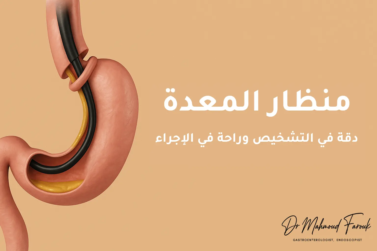 منظار المعدة: دقة في التشخيص وراحة في الإجراء