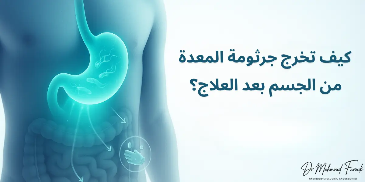 كيف تخرج جرثومة المعدة من الجسم بعد العلاج؟