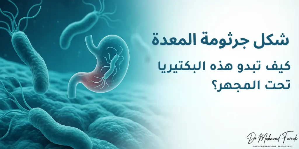شكل جرثومة المعدة