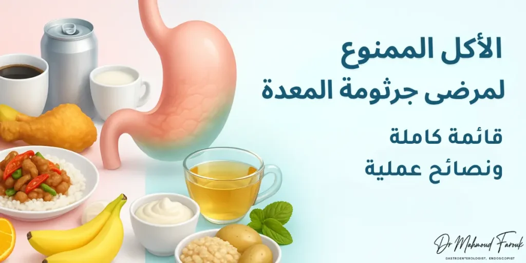 الأكل الممنوع لمرضى جرثومة المعدة