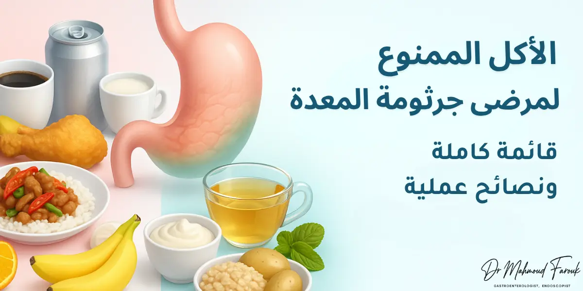 الأكل الممنوع لمرضى جرثومة المعدة: قائمة كاملة ونصائح عملية