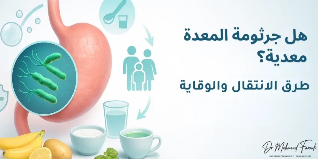 هل جرثومة المعدة معدية