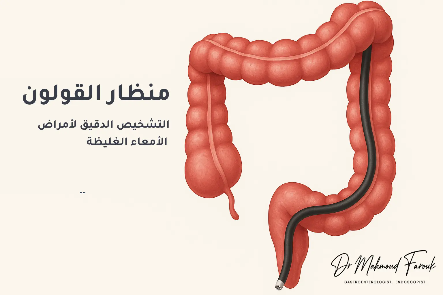 منظار القولون: التشخيص الدقيق لأمراض الأمعاء الغليظة