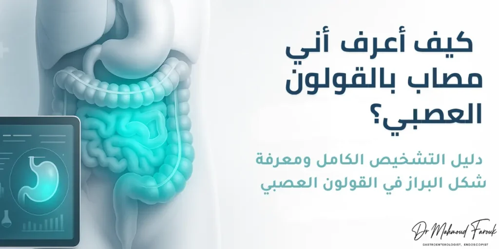 شكل البراز في القولون العصبي