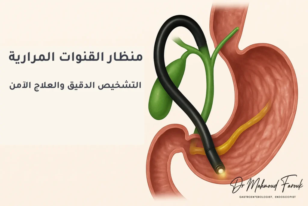 منظار القنوات المرارية: التشخيص الدقيق والعلاج الآمن