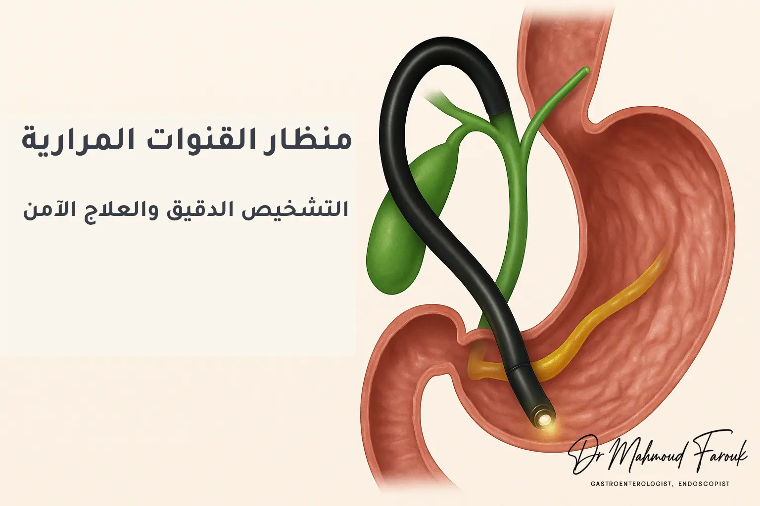 منظار القنوات المرارية
