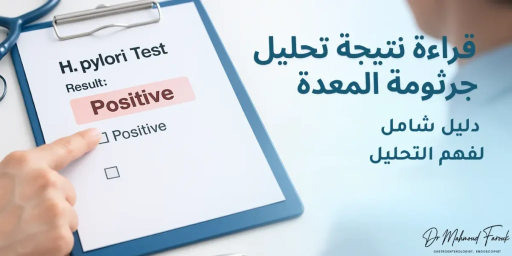 قراءة نتيجة تحليل جرثومة المعدة