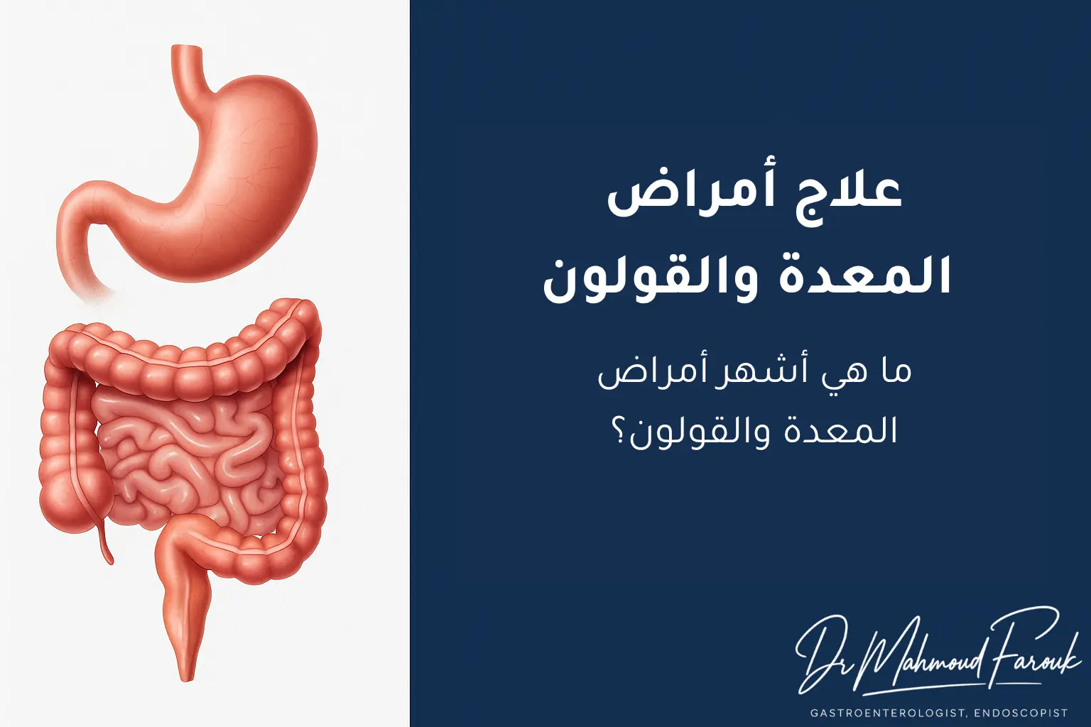 علاج أمراض المعدة والقولون