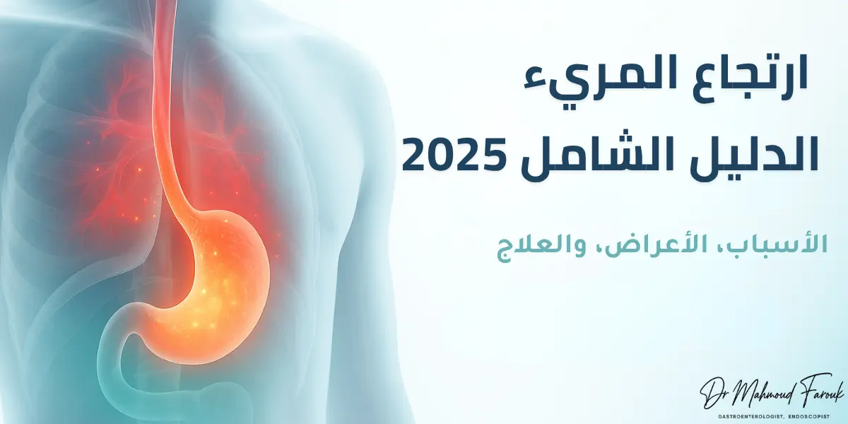 ارتجاع المريء: الدليل الشامل 2025 (الأسباب، الأعراض، والعلاج)