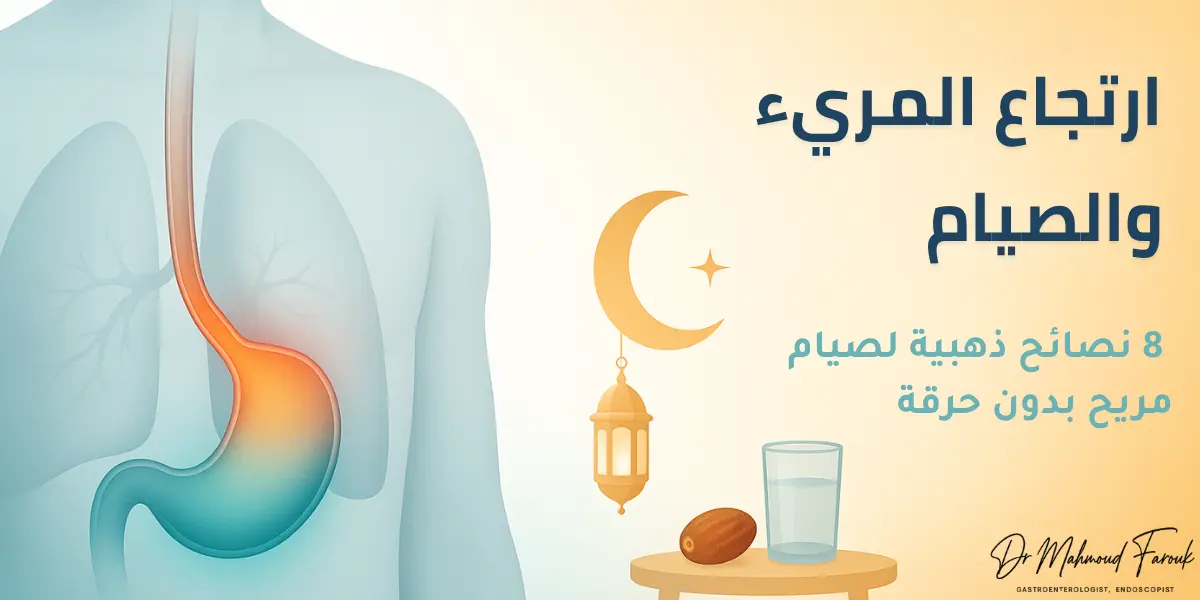 ارتجاع المريء والصيام: 8 نصائح ذهبية لصيام مريح بدون حرقة