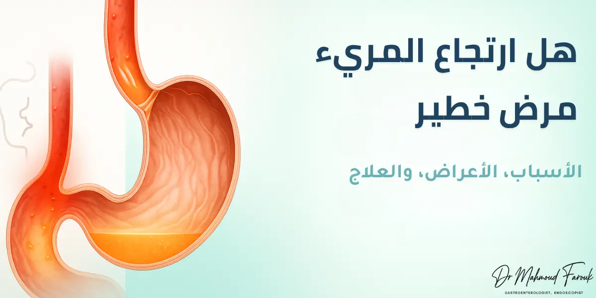 هل ارتجاع المريء مرض خطير؟ احذر 5 مضاعفات خطيرة 2025