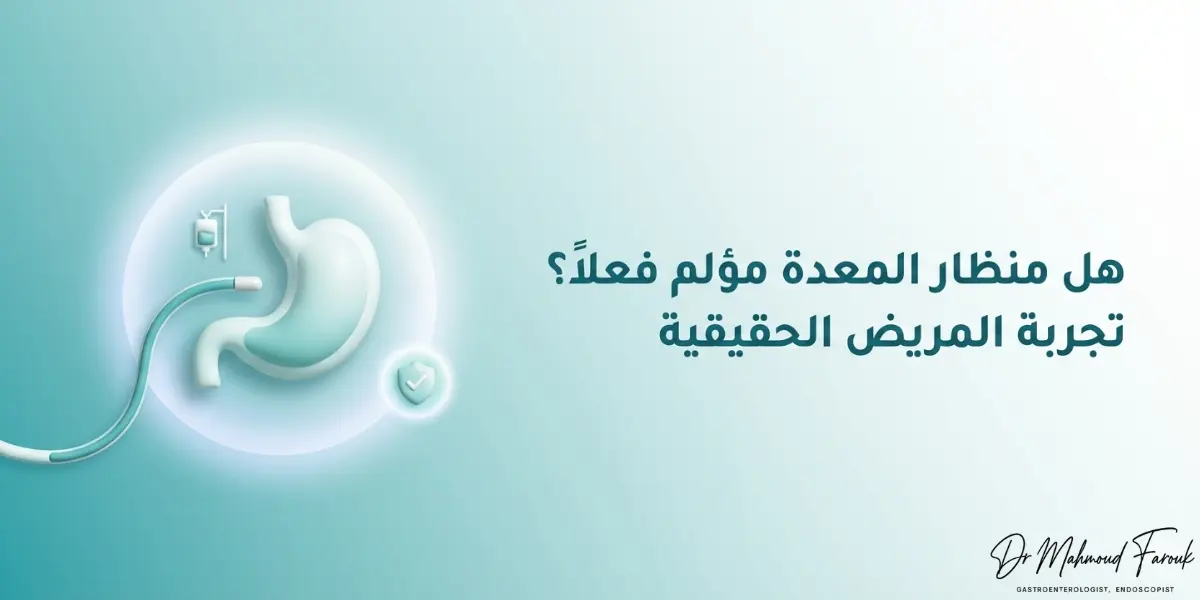 هل منظار المعدة مؤلم فعلاً؟ تجربة المريض الحقيقية والحقائق الطبية