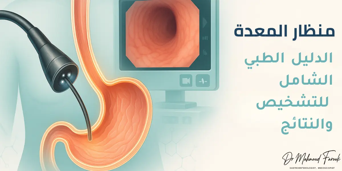منظار المعدة: دليلك الطبي الشامل لفهم الإجراء والتحضير والنتائج