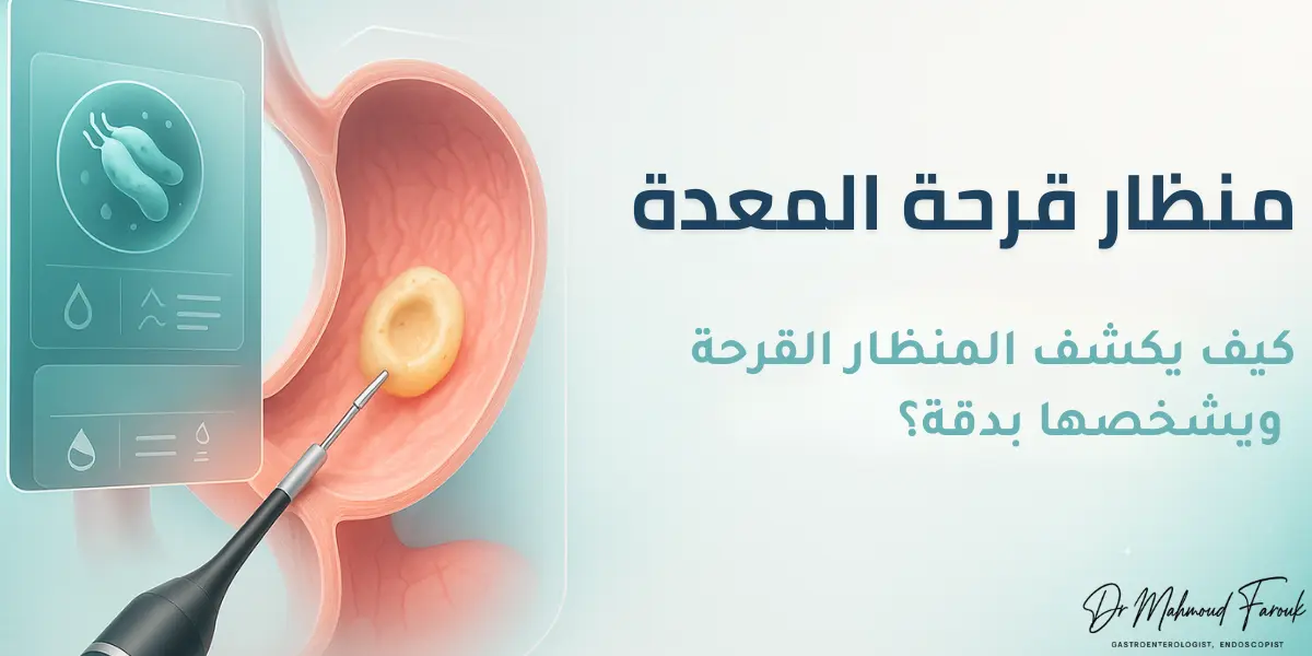  منظار قرحة المعدة: كيف يكشف المنظار القرحة ويشخصها بدقة؟