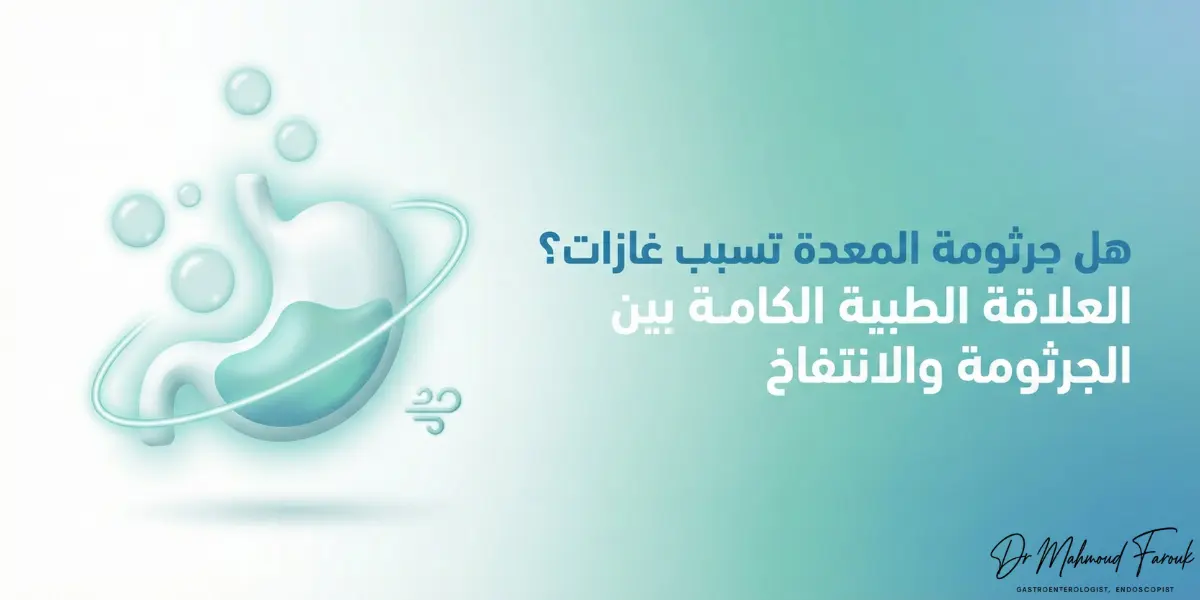 هل جرثومة المعدة تسبب غازات؟ إليك العلاقة الطبية الكاملة بين الجرثومة والانتفاخ