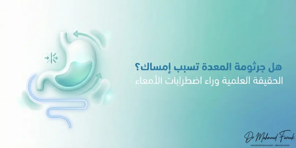 هل جرثومة المعدة تسبب إمساك