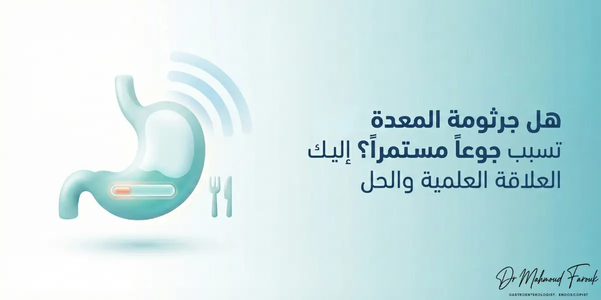 هل جرثومة المعدة تسبب جوعاً مستمراً؟ إليك العلاقة العلمية والحل