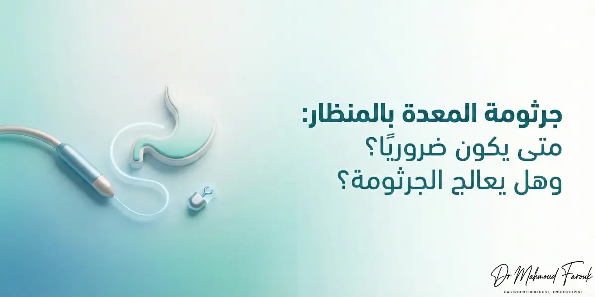 جرثومة المعدة بالمنظار: متى يكون ضروريًا؟ وهل يعالج الجرثومة؟