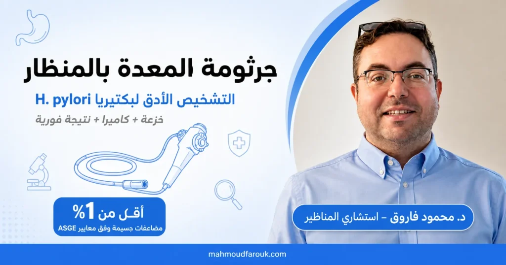 جرثومة المعدة بالمنظار