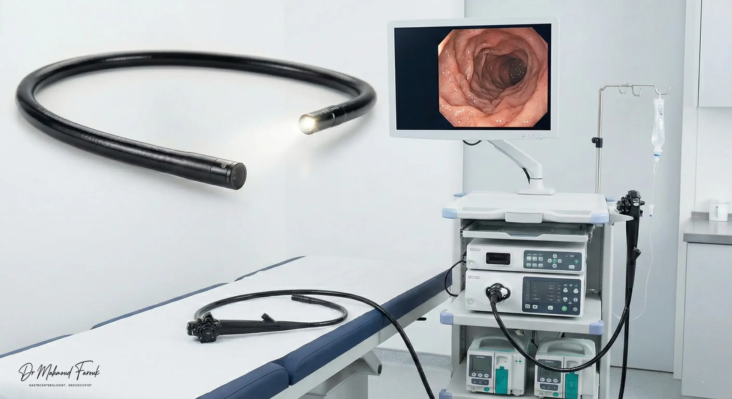 شكل منظار المعدة