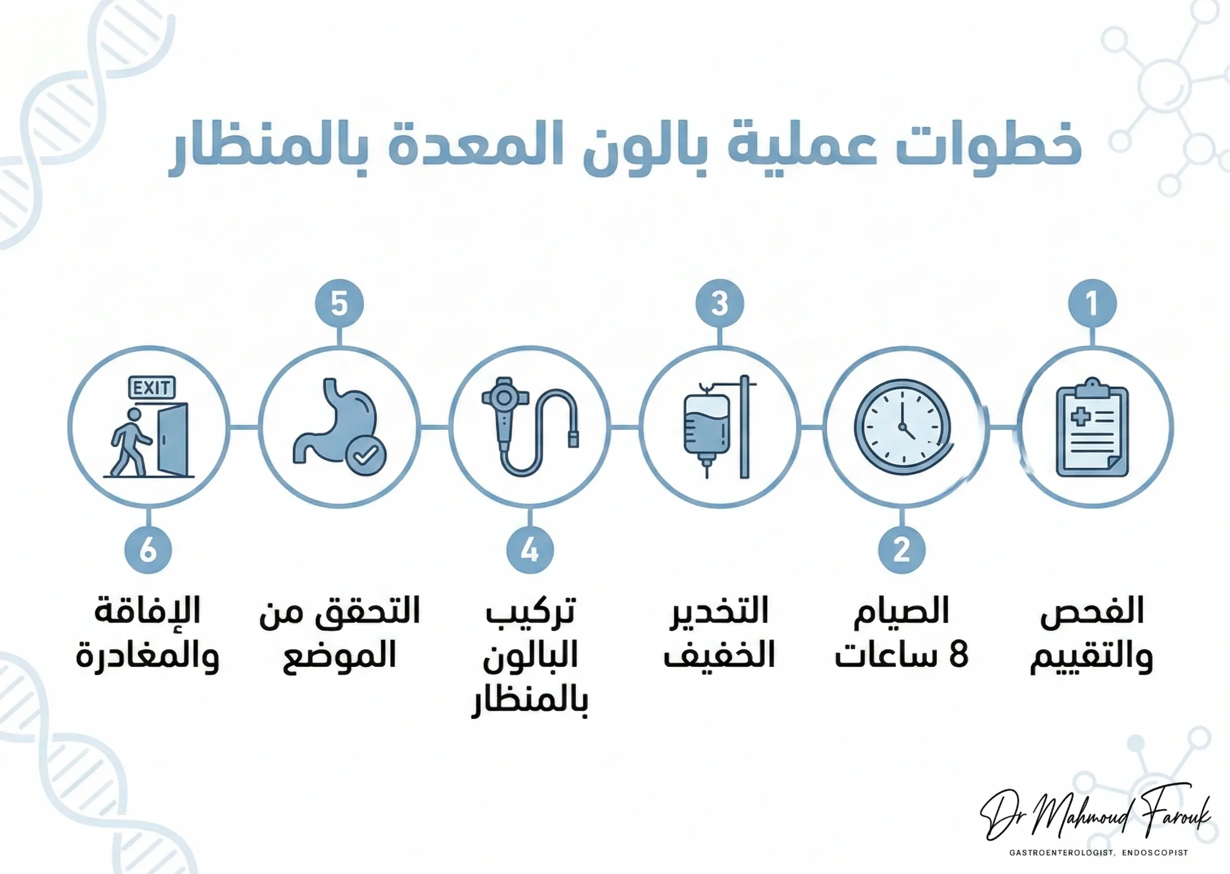 طريقة عمل بالون المعدة بالمنظار