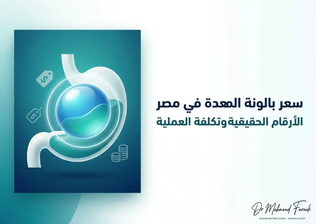 سعر بالونة المعدة في مصر