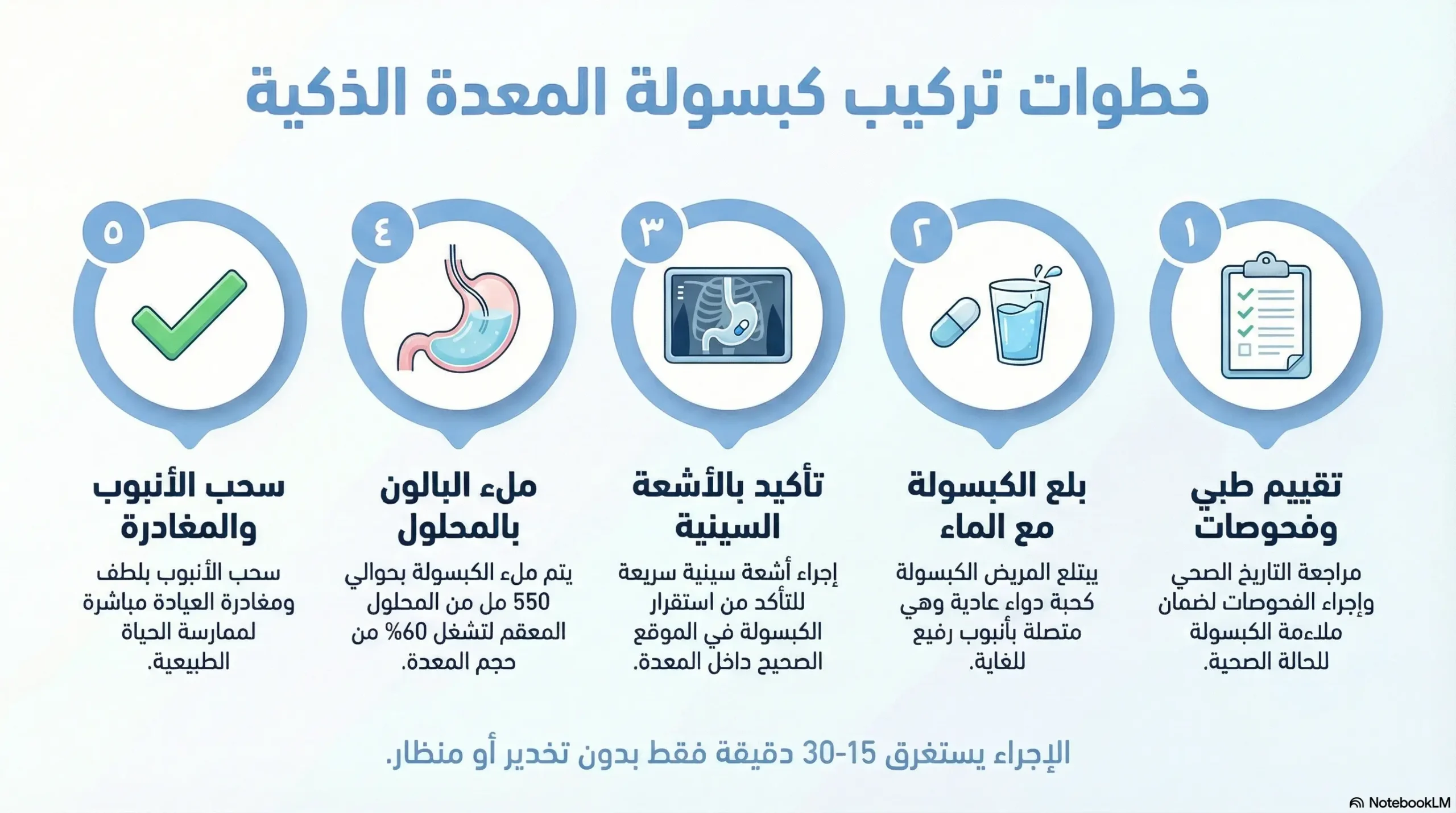 خطوات تركيب الكبسولة الذكية للتخسيس