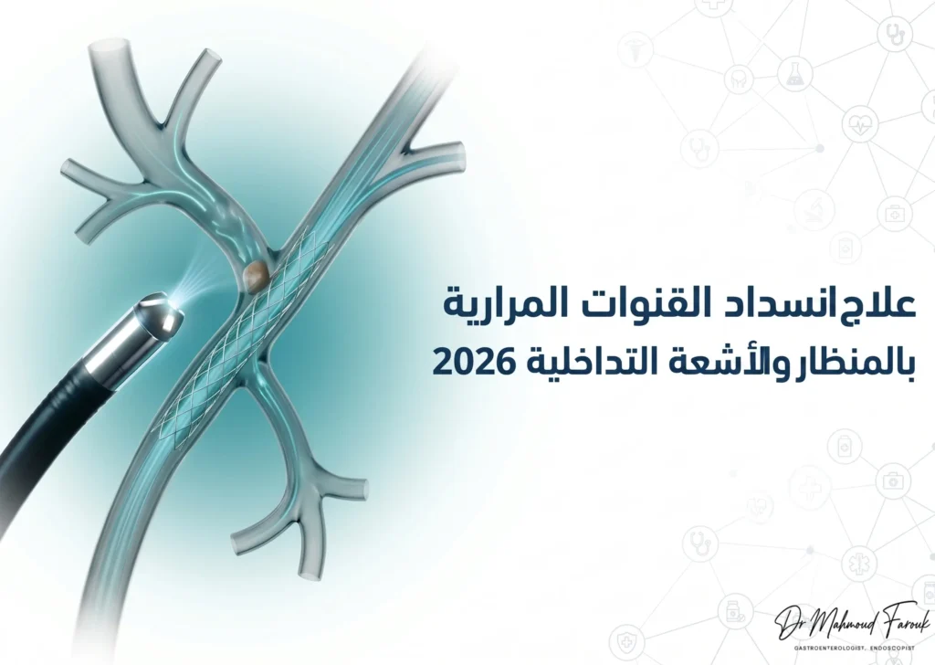 علاج انسداد القنوات المرارية