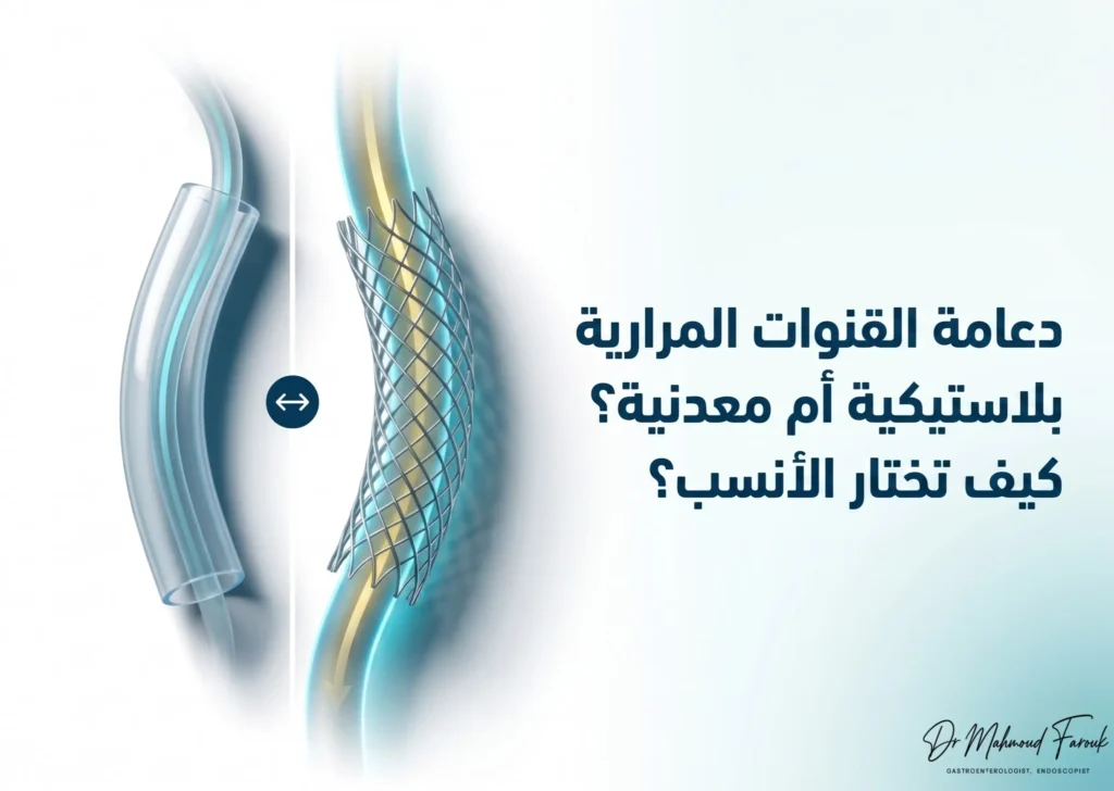 تركيب دعامة في القنوات المرارية