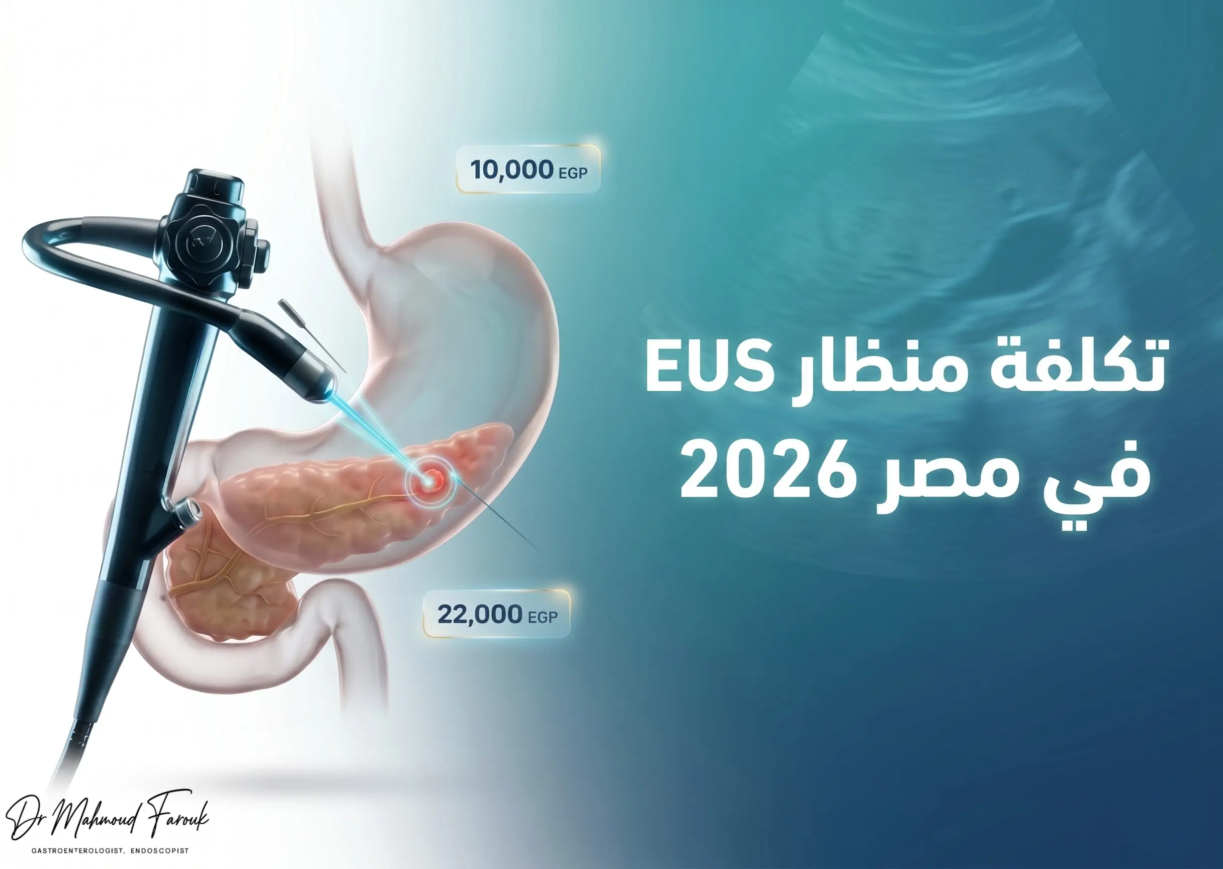 تكلفة منظار EUS في مصر 2026: من 10,000 جنيه — ما الذي يحدد سعرك؟