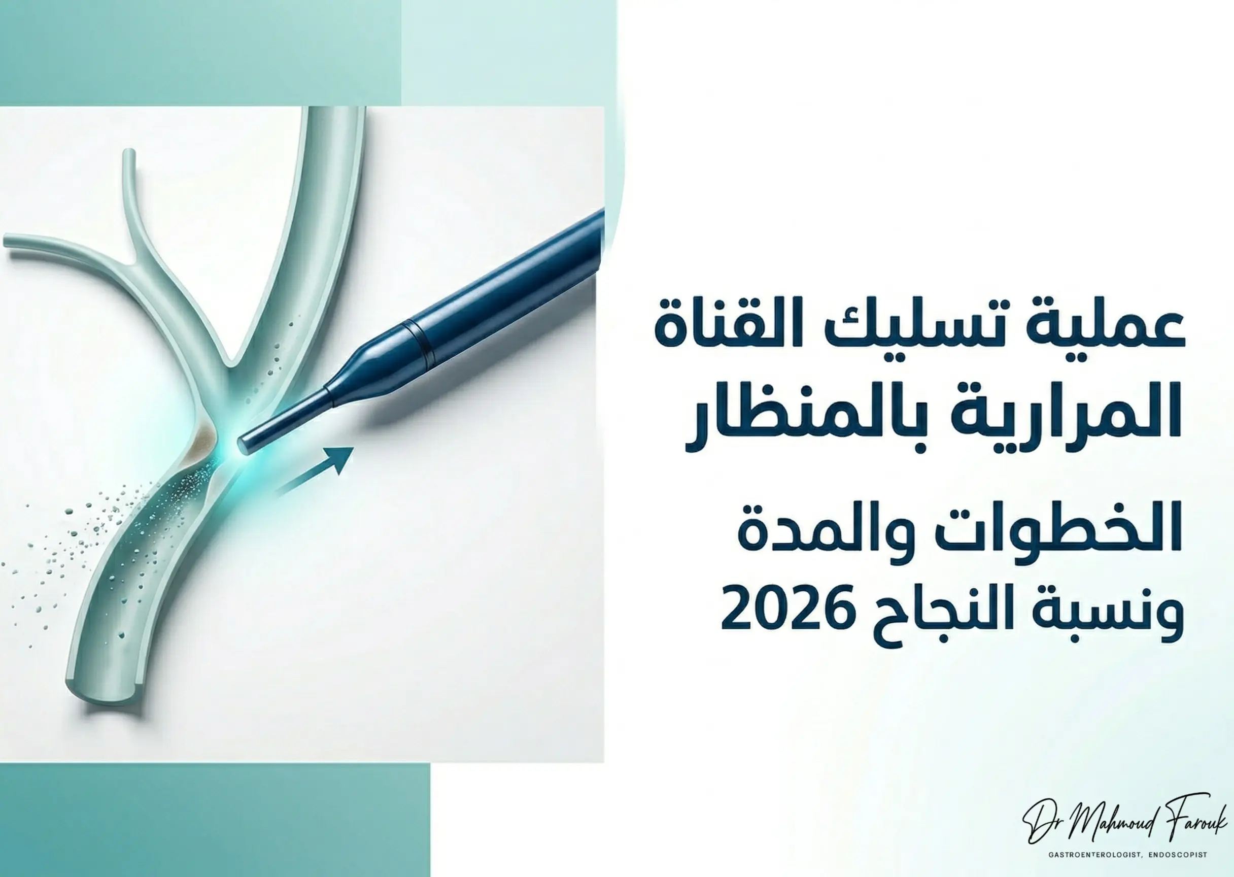 عملية تسليك القناة المرارية بالمنظار: 5 خطوات في 60 دقيقة بدون جراحة