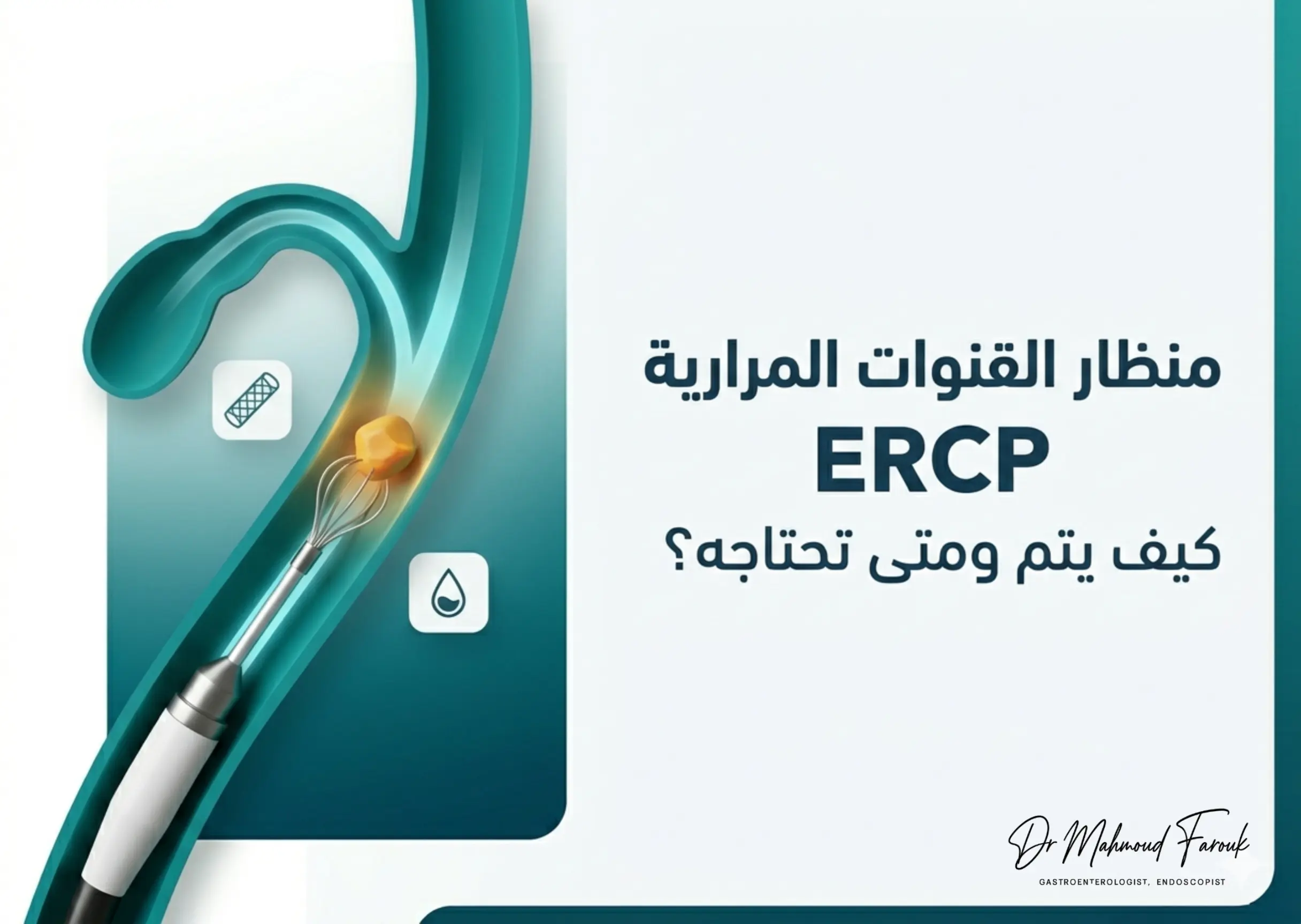 منظار القنوات المرارية والبنكرياسية (ERCP): متى يطلبه الطبيب وماذا تتوقع؟