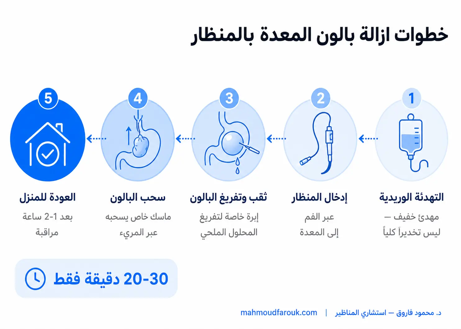 كيفية ازالة بالون المعدة بالمنظار