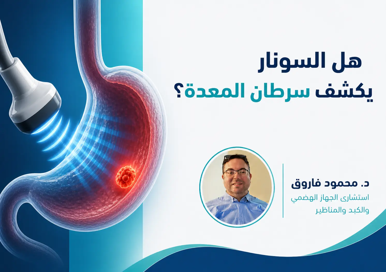 هل السونار يكشف سرطان المعدة؟ وما مدى دقته في ذلك؟