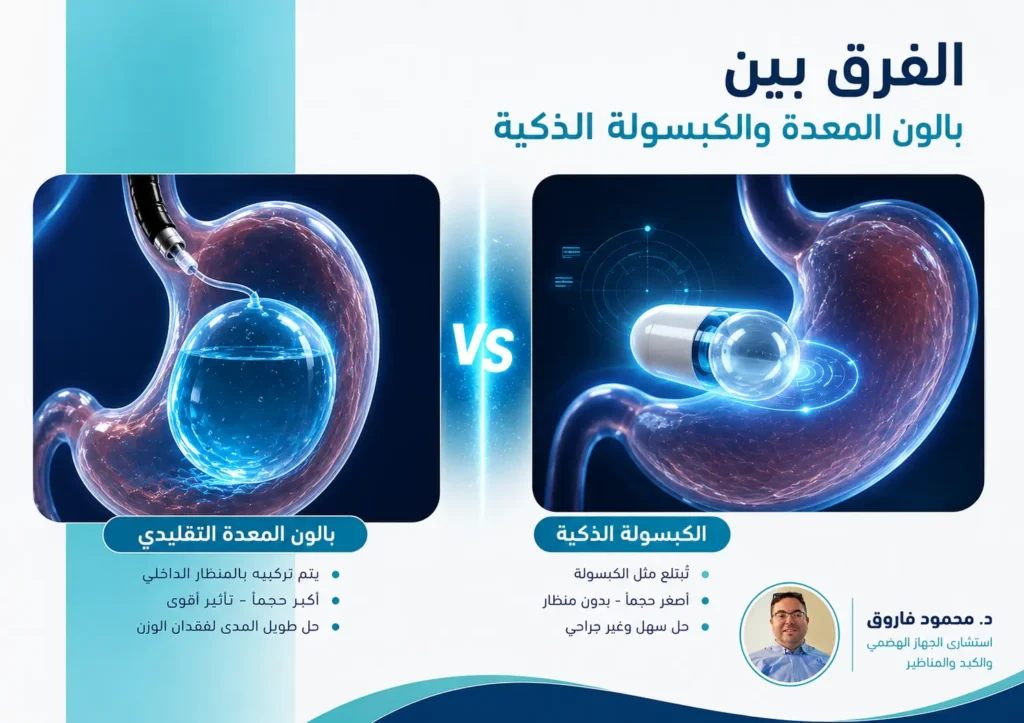 الفرق بين بالون المعدة والكبسولة الذكية