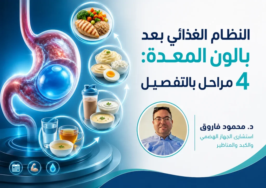 النظام الغذائي بعد بالون المعدة