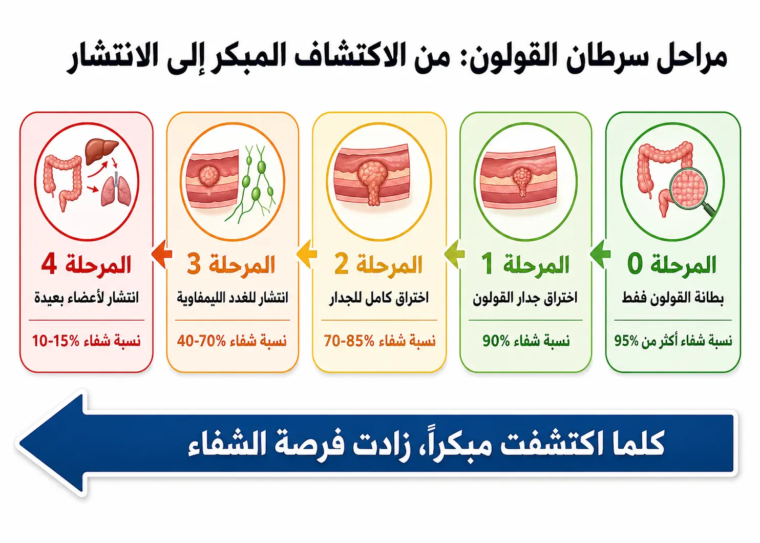 مراحل سرطان القولون