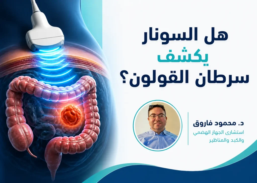 هل السونار يكشف سرطان القولون