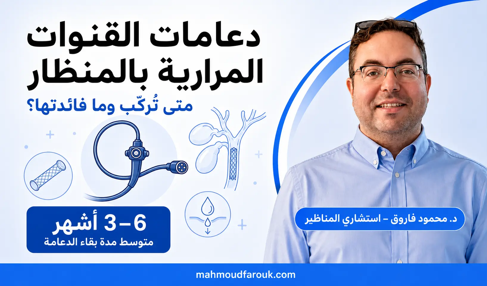 دعامات القنوات المرارية بالمنظار: متى تُركّب وما فائدتها؟