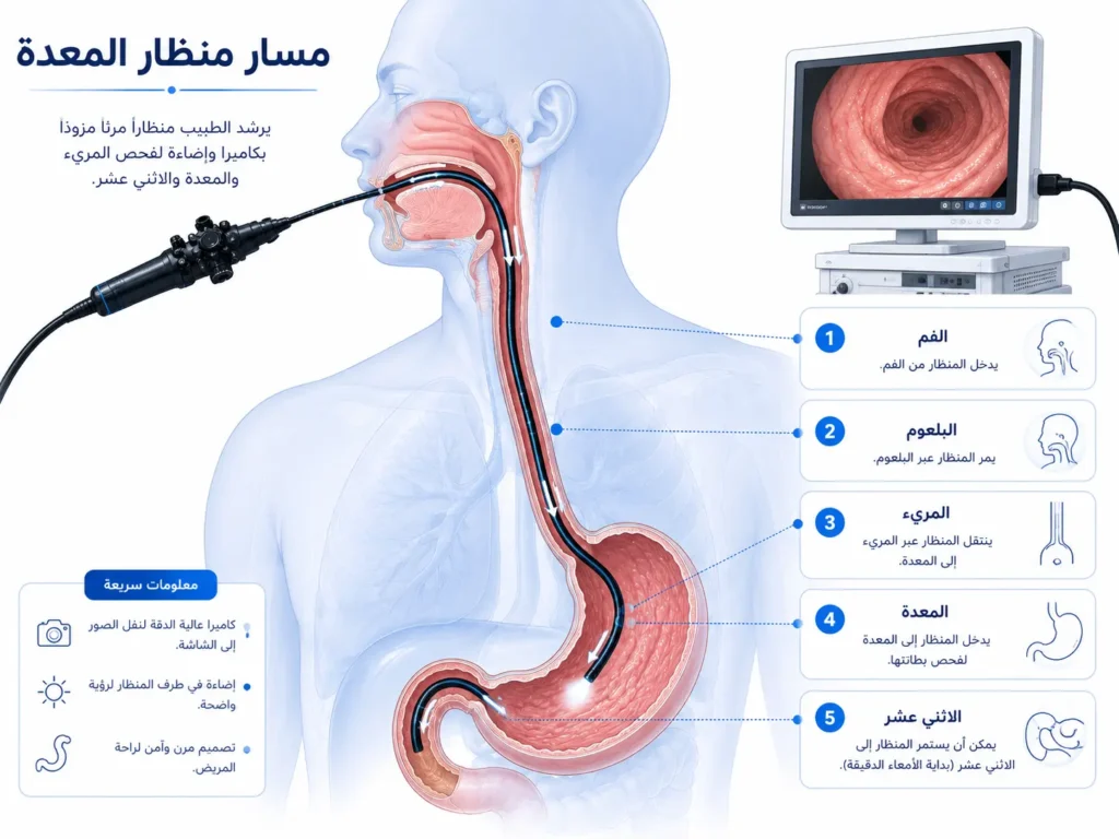 مسار منظار المعدة من الفم عبر المريء حتى المعدة والاثني عشر