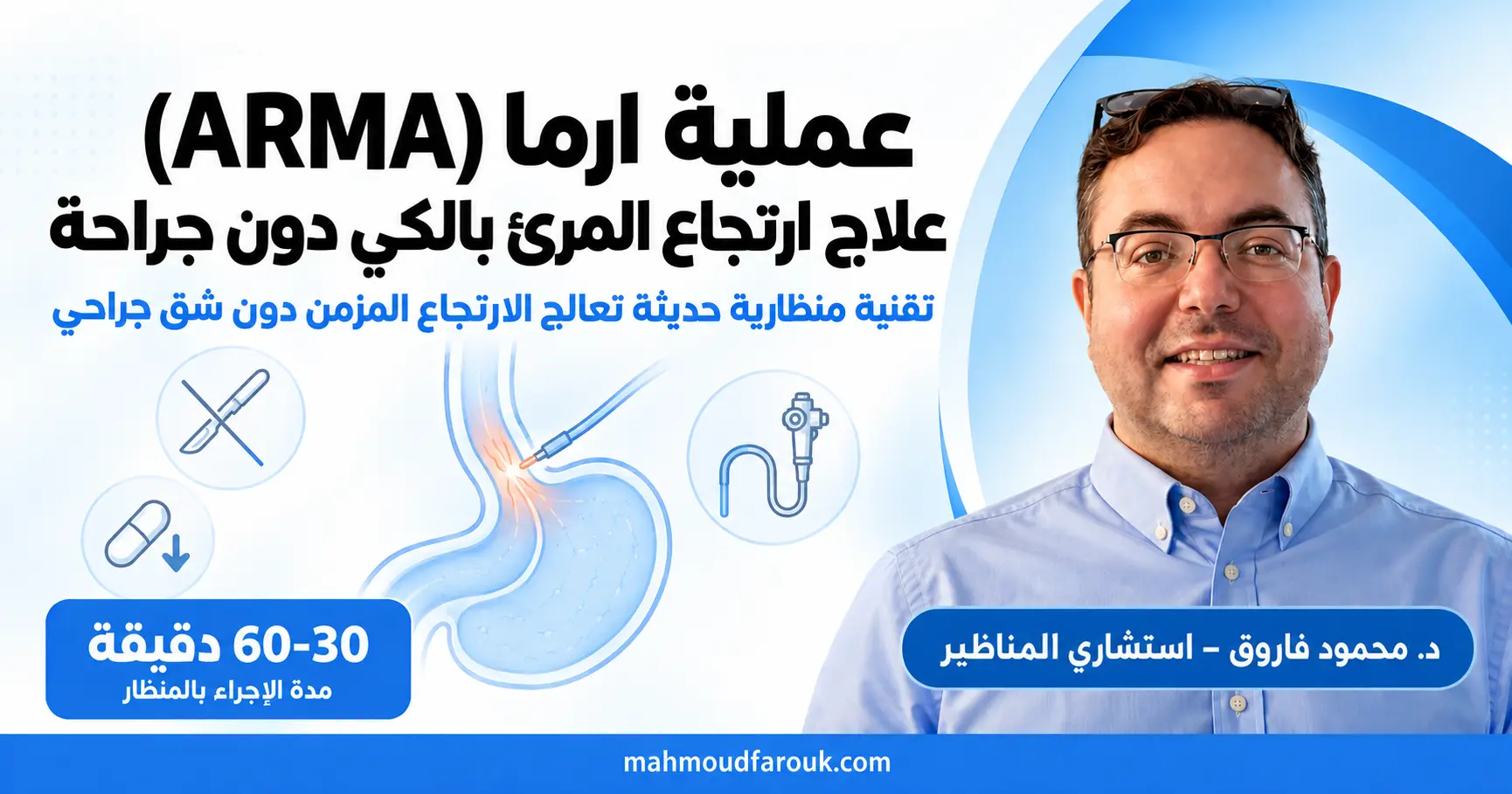 عملية ارما (ARMA): علاج ارتجاع المرئ بالكي دون جراحة